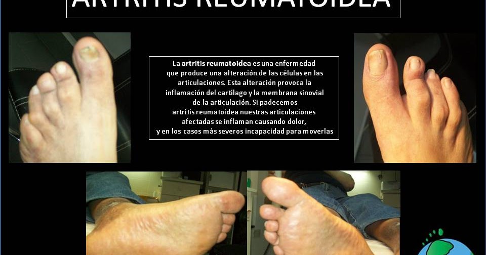 Para dejar fumar es necesario beber solamente el agua